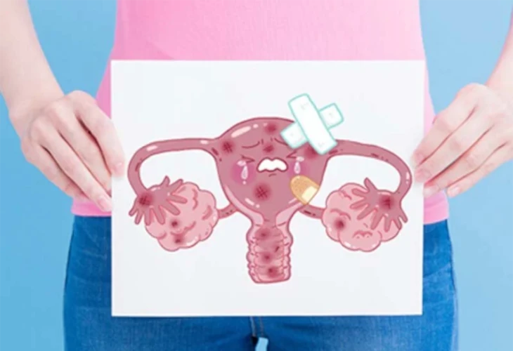 méh és petefészek ábrája