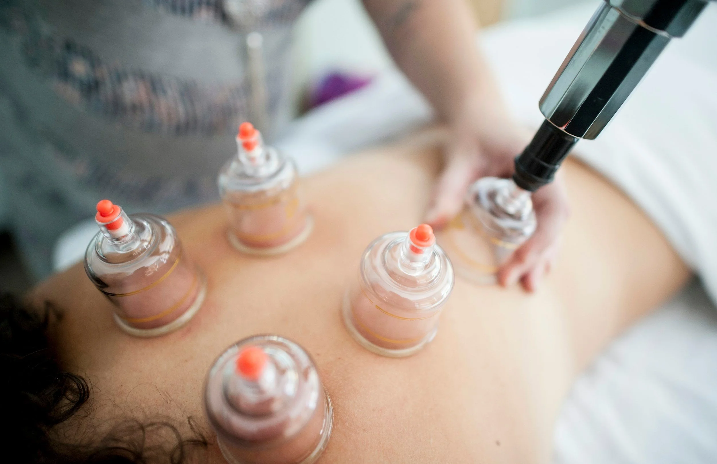 Cupping Therapy with Massage in Budapest